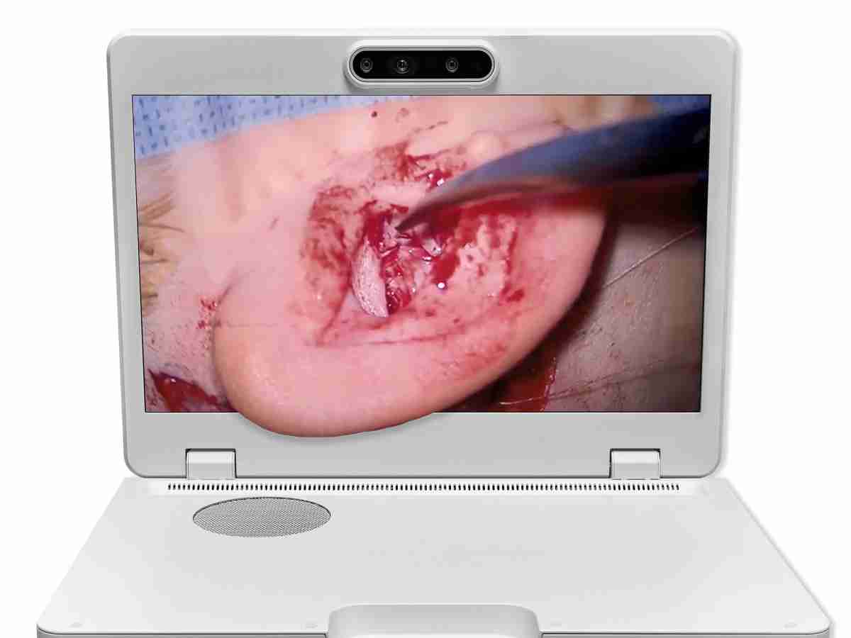 达擎之＂Heads-up 3D显微手术显示系统＂，，，整合4K裸眼3D显示及眼球追踪系统，，，，具备快速追踪人眼移动位置功能，，，减轻医师长时间维持固定姿势的负担，，让医师能有更宽广清晰的3D立体视野及更舒适的姿势来执行手术。。